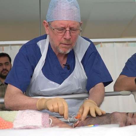 Expansores de tecido foram usados para estimular o crescimento da pele Expansores de tecido foram usados para estimular o crescimento da pele