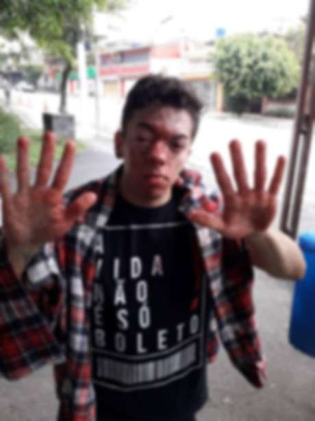 Ator Marcello Santanna afirma que foi agredido por um motorista de ônibus do transporte público de São Paulo; SPTrans afirma que repudia violência e vai colaborar com as investigações Ator Marcello Santanna afirma que foi agredido por um motorista de ônibus do transporte público de São Paulo; SPTrans afirma que repudia violência e vai colaborar com as investigações