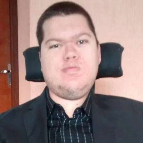 Mobilidade piorou na vida adulta, diz Odair, que sofre com vida social limitada Mobilidade piorou na vida adulta, diz Odair, que sofre com vida social limitada
