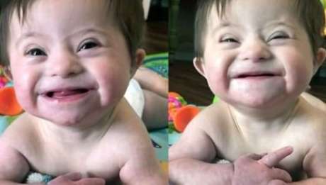 National Down Syndrome Adoption Network/ Facebook National Down Syndrome Adoption Network/ Facebook