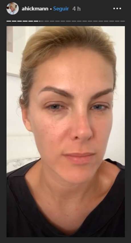 Com sintomas semelhantes aos provocados pelo novo coronavírus, Ana Hickmann mostrou que está com olhos inchados e boca ressecada. Com sintomas semelhantes aos provocados pelo novo coronavírus, Ana Hickmann mostrou que está com olhos inchados e boca ressecada.