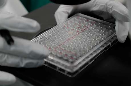 Cientista examina células infectadas por coronavírus
