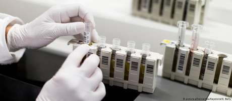 Após 57 semanas de tratamento interrompido, vírus continuou sem ser detectado no organismo do paciente brasileiro Após 57 semanas de tratamento interrompido, vírus continuou sem ser detectado no organismo do paciente brasileiro