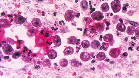 Ameba Naegleria fowleri foi associada a morte de criança nos EUA