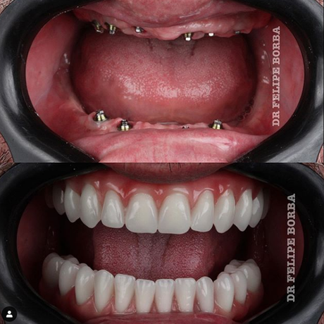 Reprodução/Instragram