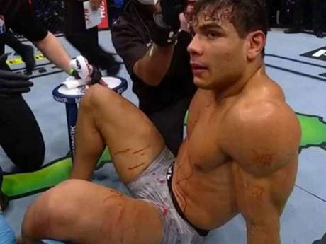 Borrachinha revelou ter tomado vinho antes da luta contra Adesanya (Foto: Reprodução/UFC) Borrachinha revelou ter tomado vinho antes da luta contra Adesanya (Foto: Reprodução/UFC)