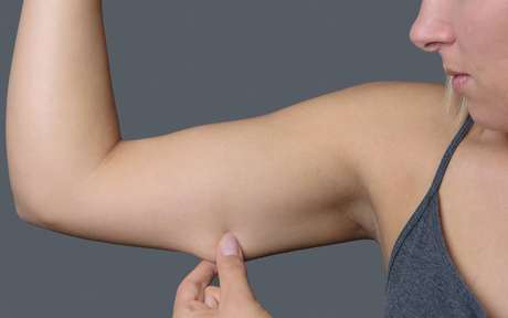 Treinar braço traz vantagens às mulheres; veja 9 razões para começar