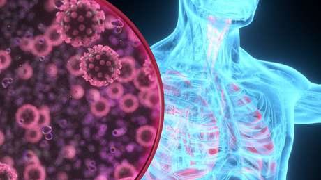 Quando infectadas pelo coronavírus, as células dos alvéolos sofrem alterações importantes que levam à sua morte