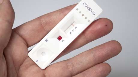 'Teste sorológico rápido feito na farmácia não vai medir se a pessoa está protegida ou não após a vacina', diz Silvia Costa, da USP