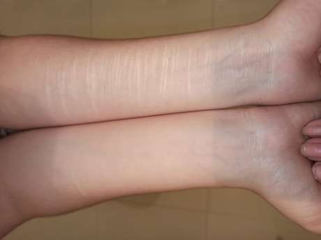 Lara mostra lesões que fez em si. Ela afirma que foi uma forma de aliviar a dor que sentiu após vídeo viralizar