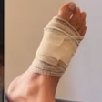 Debby Lagranha passa por cirurgia após sofrer picada de aranha-marrom