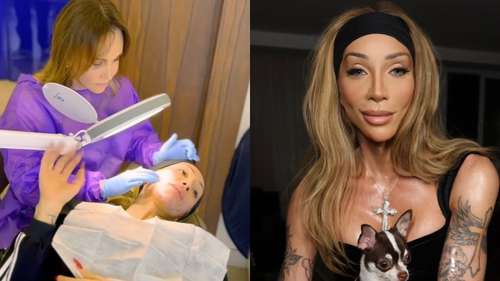 Maya Massafera Explica Procedimento Estético que Promete 