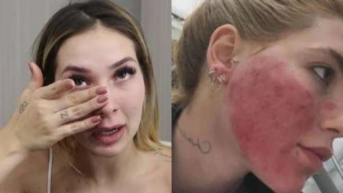 Virginia Fonseca preocupa seguidores com aparência incomum em post