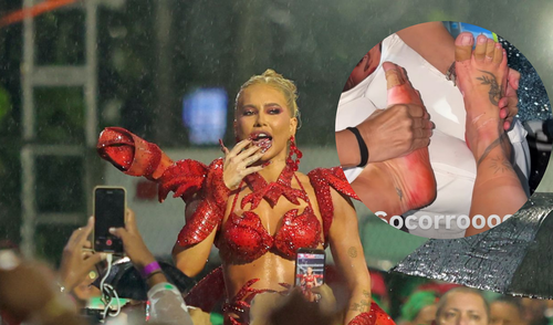 Virgínia Fonseca Revela Ferimentos Graves nos Pés Após Ensaio de Carnaval Sob Chuva Intensa
