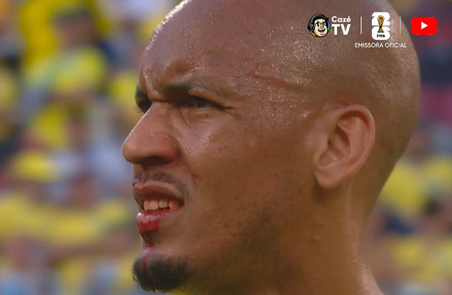 Sangrando, Fabinho teve que ser atendido fora de campo