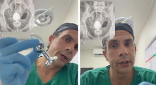 Médico alerta sobre plug anal após mulher ficar com brinquedo preso no intestino