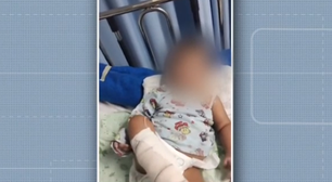 Bebê é internado com bronquiolite e precisa amputar o pé; família cita negligência