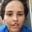 Cachorro que mordeu e arrancou lábio de tutora é sacrificado