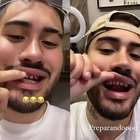Kevinho vira meme após postar foto dos dentes