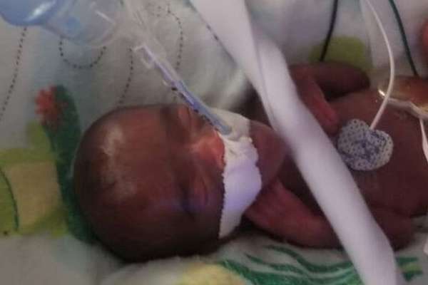 Menor Bebe Do Mundo A Sobreviver Deixa Hospital E Vai Para Casa Nos Eua