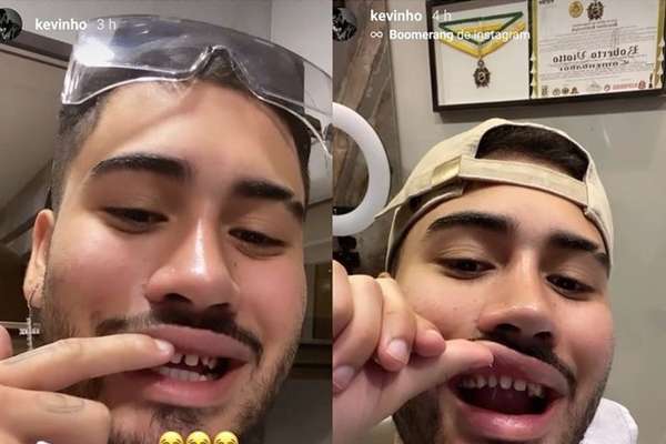 Kevinho Vira Meme Apos Postar Foto Dos Dentes