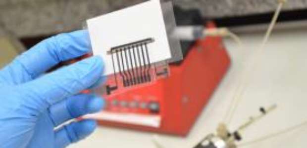 Cientistas da UFSCar simplificam diagnóstico de Alzheimer
