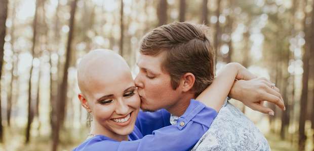 A mulher que tirou a peruca e decidiu assumir alopecia ...