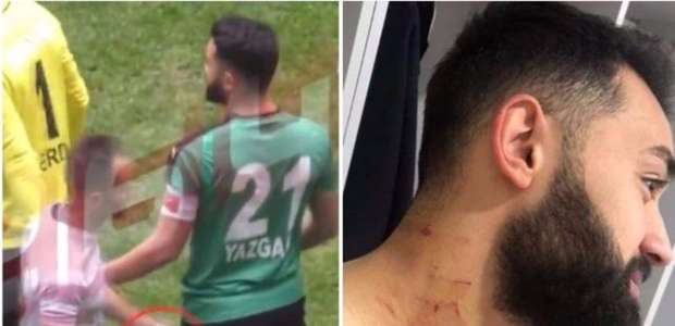Jogador turco acusado de ferir adversários com uma ...