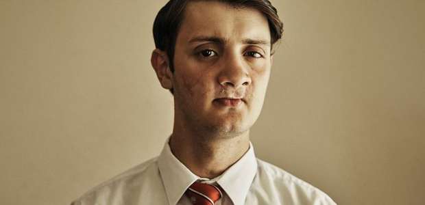 'Tomei seis tiros no rosto e sobrevivi'