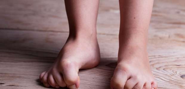 Dedo em garra é comum em mulheres, aponta pesquisa