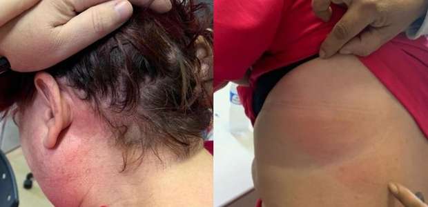 RS: Homem agride médica obstetra com socos e chutes em ...