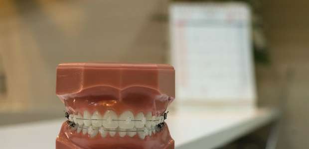 Sem sorriso frouxo! Dentista tira dúvidas sobre dentadura
