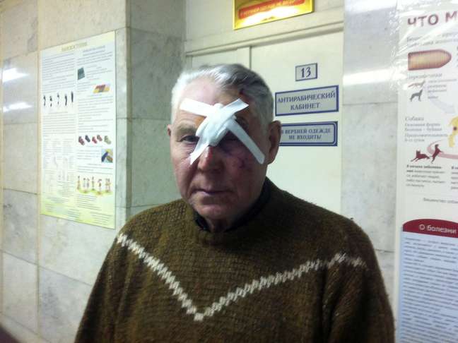 <p>Homem foi socorrido após ser atingido por estilhaços de vidro na região de Urals</p>