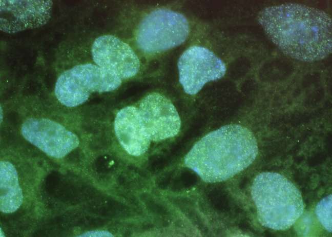 Células-tronco são vistas em tela de computador