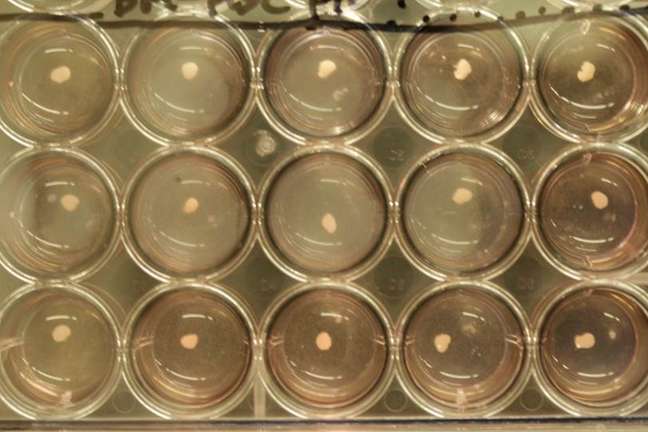 Imagem mostra brotos hepáticos desenvolvidos em laboratório