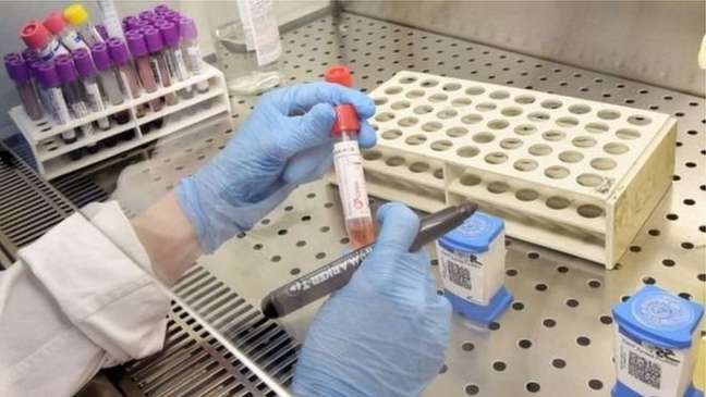 Ministério da Saúde confirmou mais de 5,7 mil casos de coronavírus no Brasil