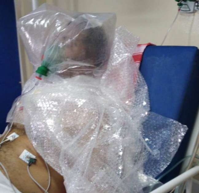 Paciente respira com um saco plástico improvisado por falta de equipamento em Manaus