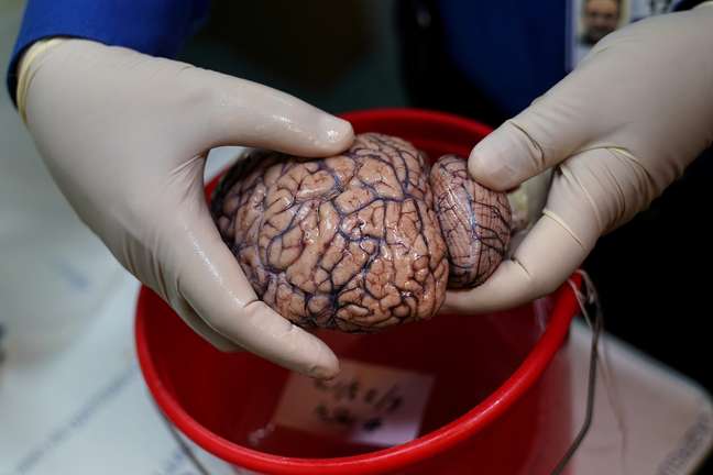 Pesquisador segura cérebro humano em Nova York
28/06/2017 REUTERS/Carlo Allegri