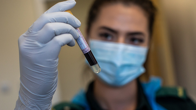 Sociedade médicas brasileiras não indicam a realização de exames que medem níveis de anticorpos após a vacinação Sociedade médicas brasileiras não indicam a realização de exames que medem níveis de anticorpos após a vacinação