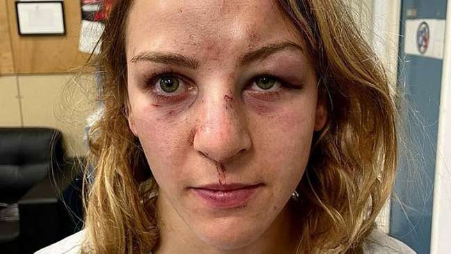 Margaux Pinot mostra rosto machucado após ser vítima de agressão por parte do marido