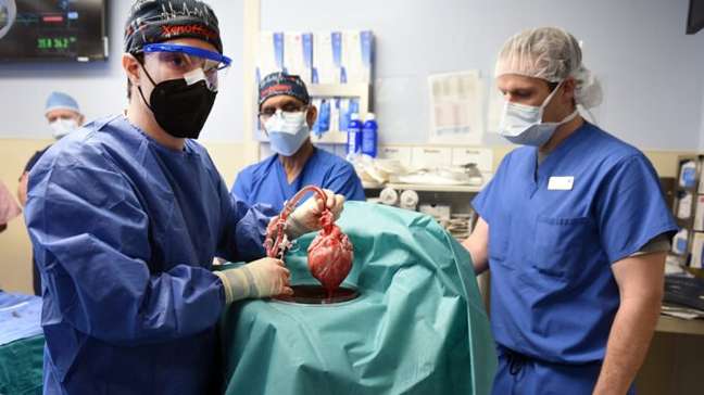Cirurgiões exibem coração suíno antes dele ser implantado no paciente 