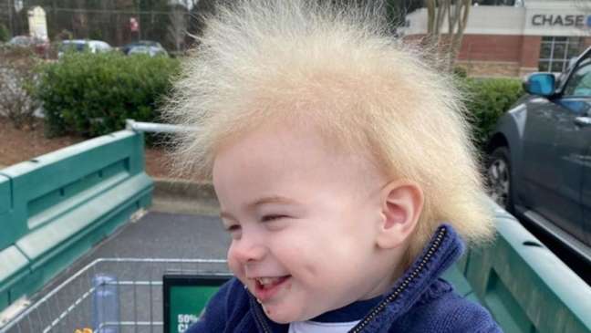 Os cabelos de Locklan começaram a mudar quando ele tinha seis meses