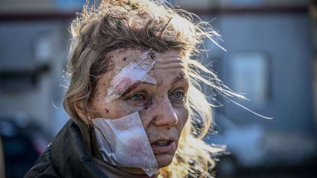 Mulher ferida do lado de fora de um hospital após o bombardeio da cidade de Chuguiv, no leste da Ucrânia, no dia 24 de fevereiro de 2022