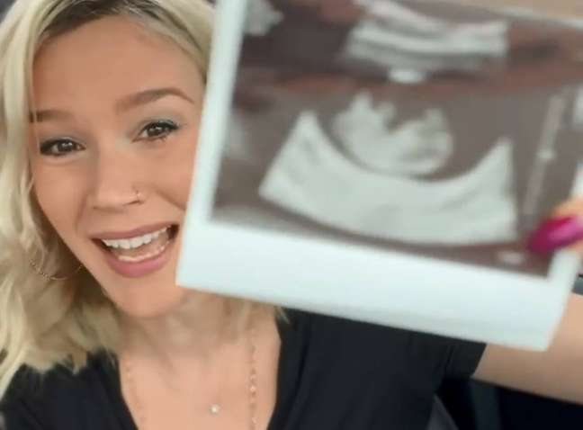 Cinco meses após sofrer um aborto espontâneo, Joss Stone engravida novamente e comemora a vinda de um ‘bebê arco-íris’.