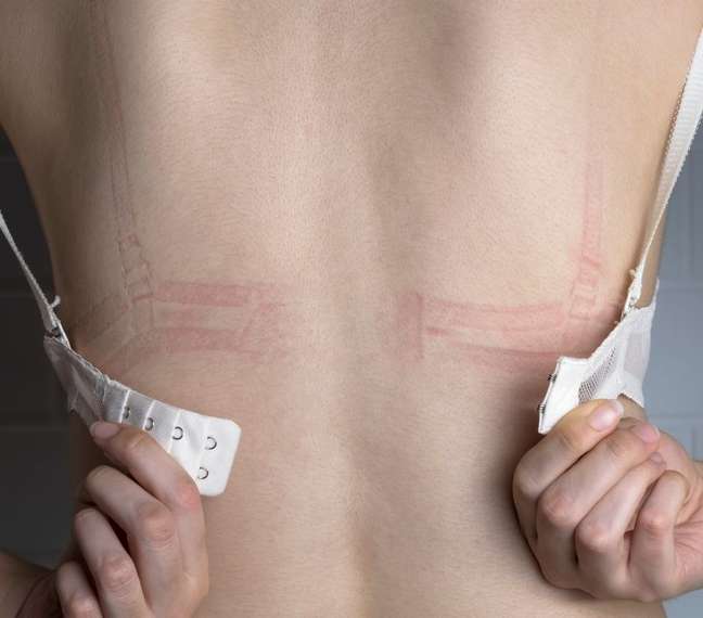 O que é melhor: usar ou não sutiã?