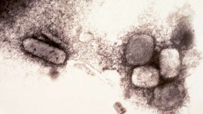 Visão microscópica do vírus que causa a varíola