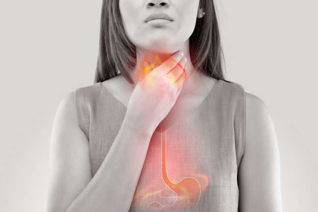 Quando acontece de forma frequente, o retorno do conteúdo do estômago para o esôfago é caracterizado pela doença do refluxo gastroesofágico