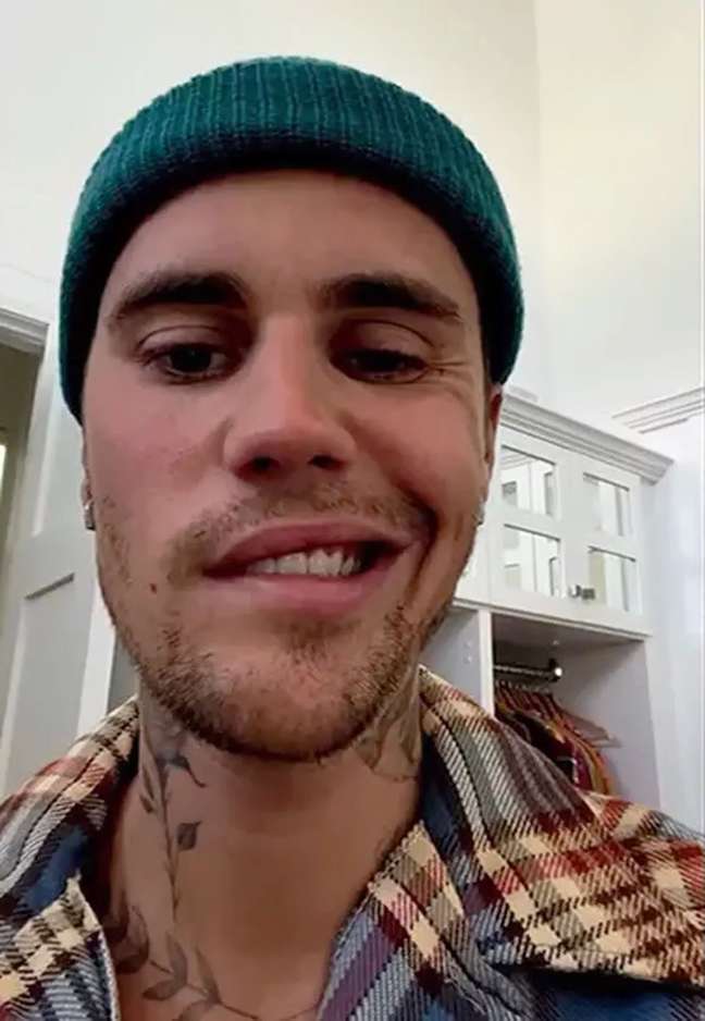 Justin Bieber reveals facial paralysis: “I trust in God” Justin Bieber reveals facial paralysis: “I trust in God”