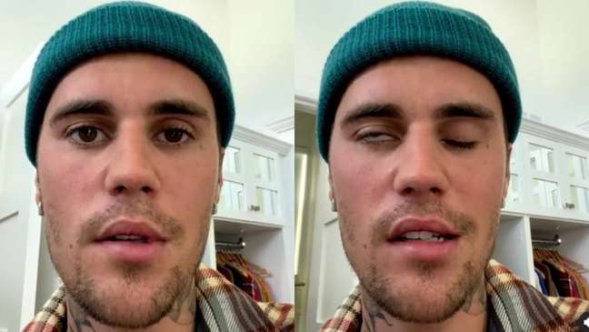 Justin Bieber and other artists openly share their health problems
