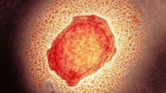 Partícula do vírus da varíola dos macacos; Brasil tem dois casos confirmados